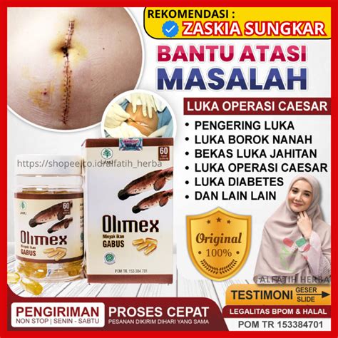 Jual Olimex Official Store Minyak Ikan Gabus Pasca Operasi Caesar Sesar