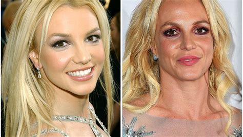 Britney Spears Plastic Surgery — An Expert Breaks Down Her Look