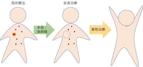 治療の概要｜治療について｜乳がんinfo｜診療について｜横浜市立みなと赤十字病院 ブレストセンター