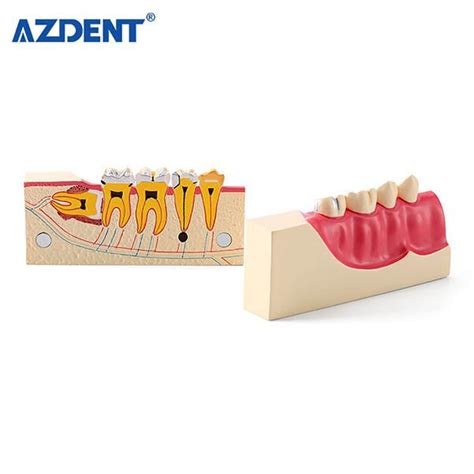 China Dental Teaching Model Manufacturers Suppliers Factory Price