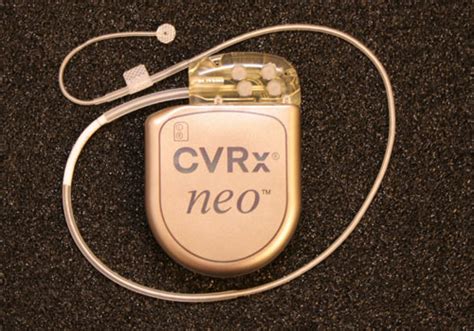 Cvrx Barostim Neo Implantable Device Dandy Gadget