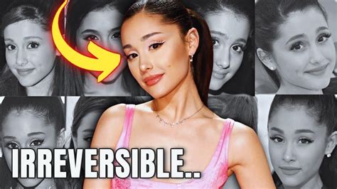 What HAPPENED To Ariana Grande S EYES Plastic Surgery Analysis