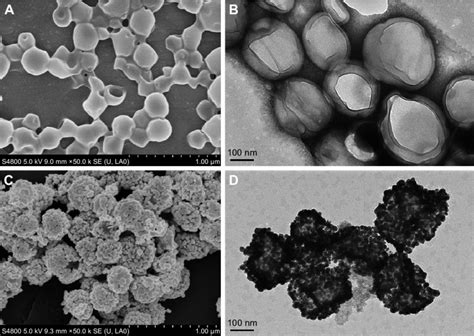 seM scale 1 µm and TeM scale 100 nm of Plga Ncs A B and DNcs