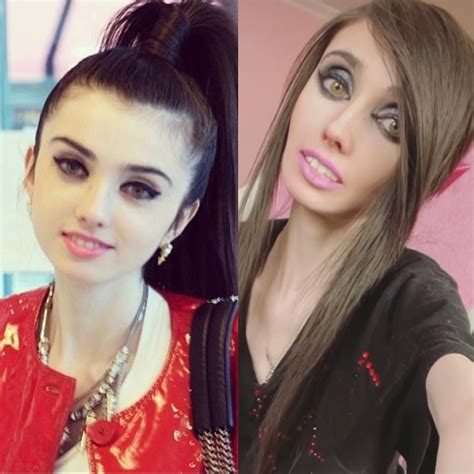 Side by side you can really see what years of this illness has done to