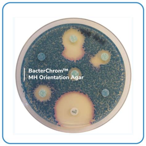 Bacterchrom Orientation Agar Labone Scientific Co Ltd