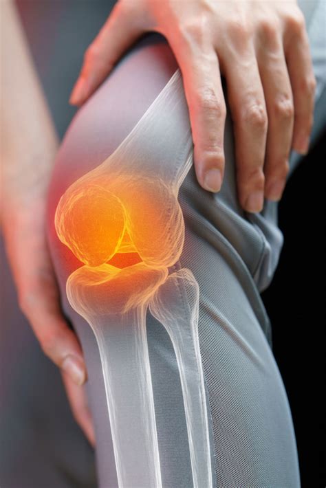 Explore Knee Replacement Alternatives Non Surgical Options