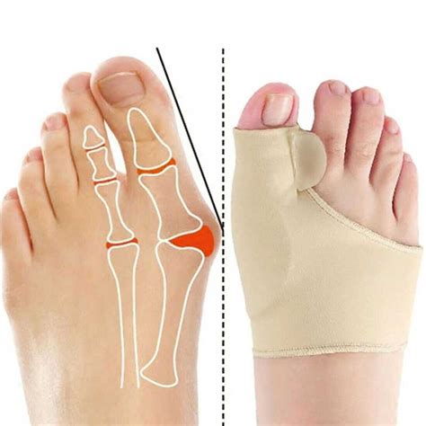 Correcteur Orthop Dique Hallux Valgus