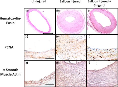 Gingerol Inhibits Serum Induced Vascular Smooth Muscle Cell