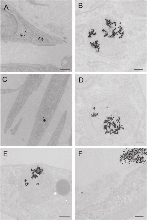 Transmission Electron Micrographs Of Equine Fibroblasts After