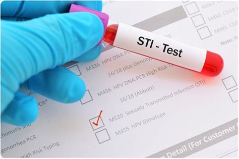 COVID-19 and Sexually Transmitted Infections