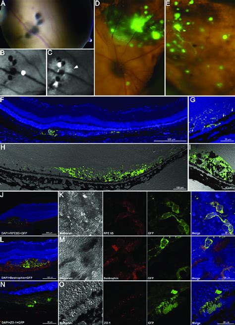 Hesc Derived Rpe Cells Survive Integrate And Express Rpe Markers