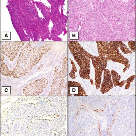 Histopathological And Immunohistochemical Findings Squamous Cell Download Scientific Diagram