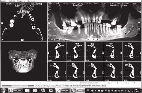 Cone Beam Reconstruction Including Generated Ortopantomogram