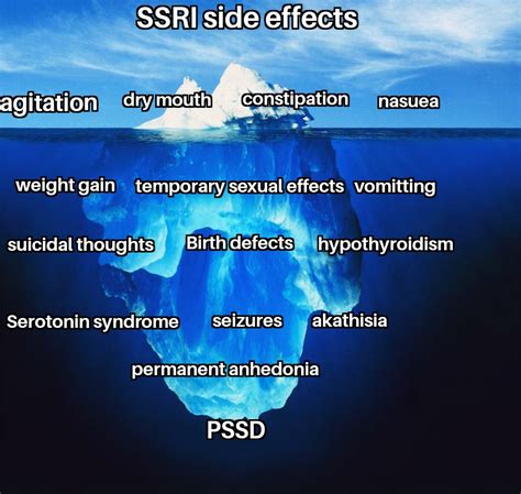 SSRI(antidepressants) Side effects : r/IcebergCharts