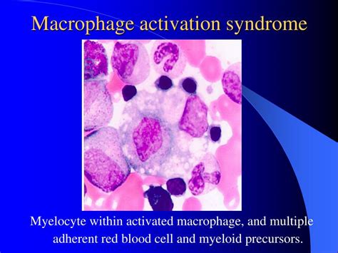 Ppt Auto Immune Diseases Powerpoint Presentation Free Download Id 706579