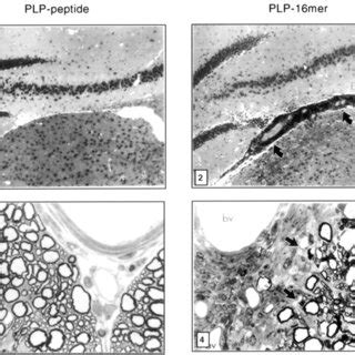 Induction Of Eae With Mbp Oligomers Clinical Scores Of Mice