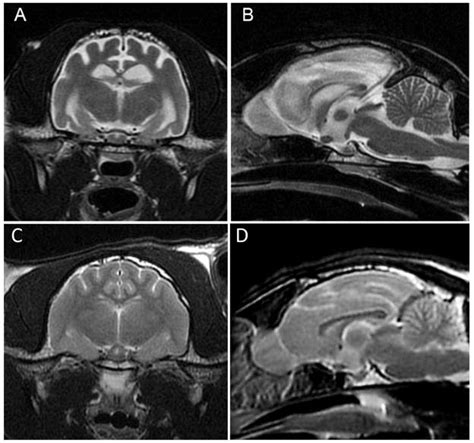 Axial A And Sagittal B T Weighted Magnetic Resonance Images Of The