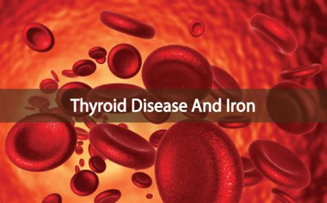 Thyroid Disease And The Connection To Iron Deficiencies