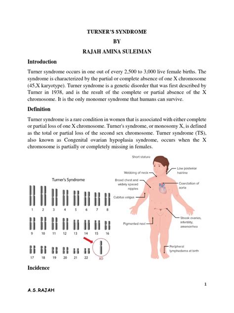 TURNER Syndrome | Download Free PDF | Medical Specialties | Clinical Medicine