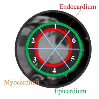 A The Six Sectors Of The Myocardium B Comparison Of The Area Of