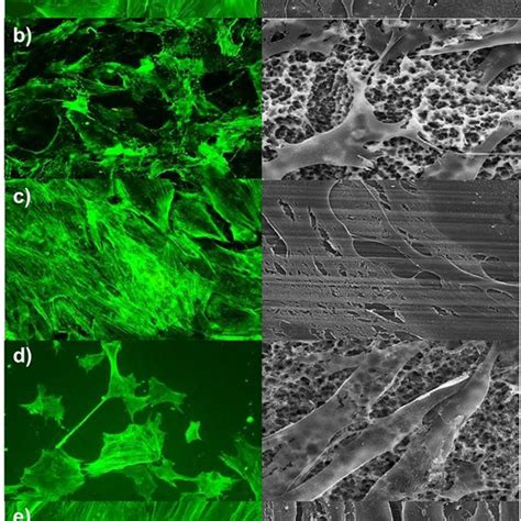 Alterations In The Cell Morphology Of Human Gingival Fibroblasts Cells