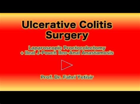 Ulcerative Colitis Surgery YouTube