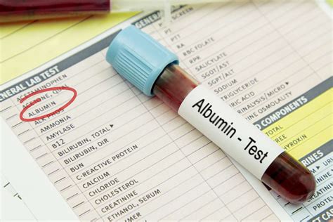 Albumin Blood Test: Normal and Abnormal Levels