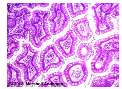 Exam 1 Photomicro Graphs Flashcards Quizlet