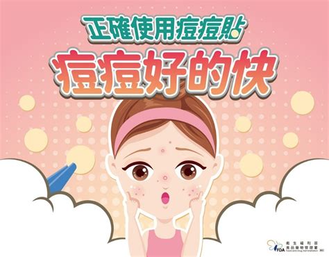 臉部冒青春痘，痘痘貼貼多久才有效？使用、更換時機一次看 食品藥物管理署 健康遠見