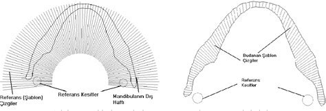 Figure 4 From Stress Analysis Of Human Mandible With The Use Of Finite