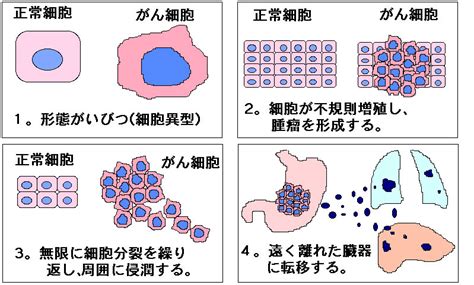 肺腺ガン 専門 治療 病院 近赤外線治療でガン細胞が破壊できるとアメリカのガン開発研究センターが発表 日本ではガンの薬はまだまだ未開発