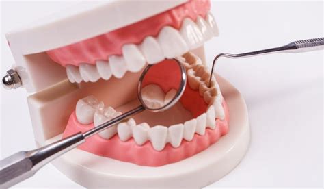 A Guide To Find The Best Dental Implants In Sydney