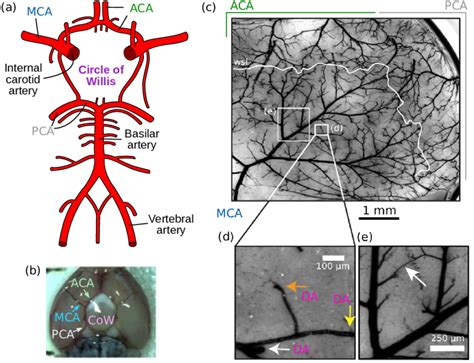 schematic drawing   circle  willis    main