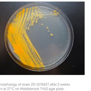 Genome Sizes Plasmid Numbers Predicted Coding Proteins RRNAs And