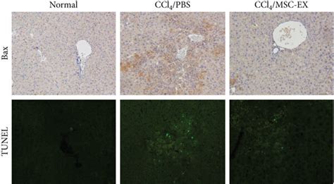 Hucmsc Ex Reduced Oxidative Stress In Acute Liver Injury A B