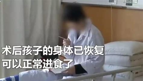 19歲女孩誤吞鋰電池，殘留胃中14天，醫生：幸好還在胃裏 每日頭條