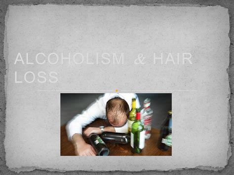 Alcohol & hair loss by Clinichealth - Issuu