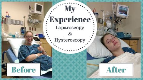 My Laparoscopy And Hysteroscopy Experience Do I Have Endometriosis