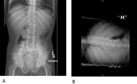 Abdominal X Ray Labeled