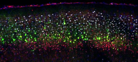 The Diversity Of Cortical Neur [image] Eurekalert Science News Releases