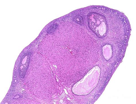 Corpus Luteum Photograph by Jose Calvo / Science Photo Library