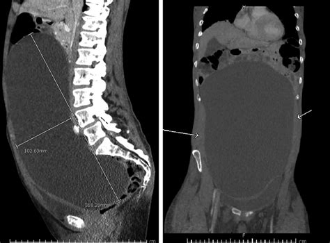 A And 1b Cross‐sectional Imaging Demonstrating Sagittal Figure 1a Download Scientific