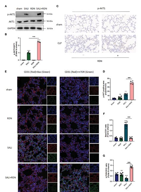 Figure 2 From Reduning Alleviates Sepsis Induced Acute Lung Injury By