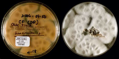 Fusarium solani implicated in fungal meningitis outbreak tied to ...