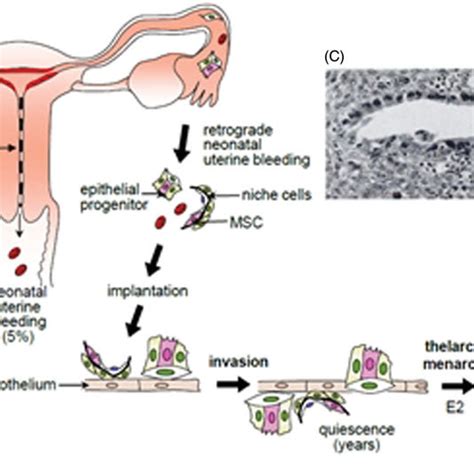 Schematic Description Of The Hypothesis Of A Role Of Endometrial