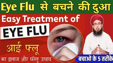 Eye Flu Se Bachne Ki Dua Eye Flu Hone Par Kya Karen Eye Flu Treatment Youtube