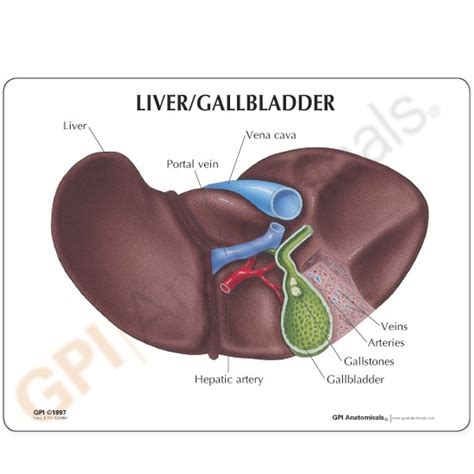 Liver Gallbladder Anatomical Model With Gallstones