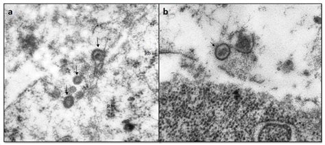 Viruses | Special Issue : Oncolytic Viruses