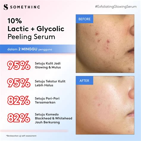 Buy SOMETHINC Paket Best Seller Layering Serum Berlian Advanced User