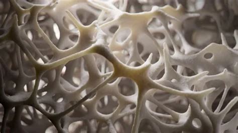 Slowmotion shot of spongy bone tissue gr... | Stock Video | Pond5